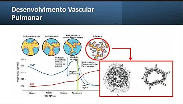 Por que o prematuro é diferente