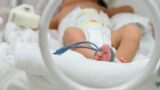 Procedimentos em Neonatologia - Módulo Surfactante